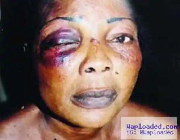 Omg!! See What A 78 Year Old Woman Did To Her Daughter In-law